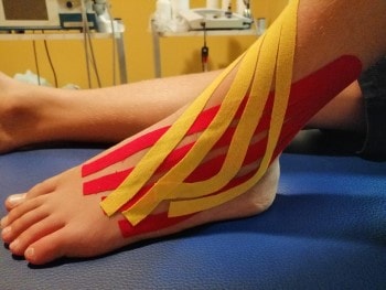 Kinesio taping